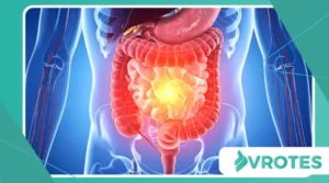 The Link Between Gut Inflammation and Anxiety